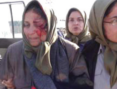 Female residents of Camp Ashraf injured in 7 January 2011 attack